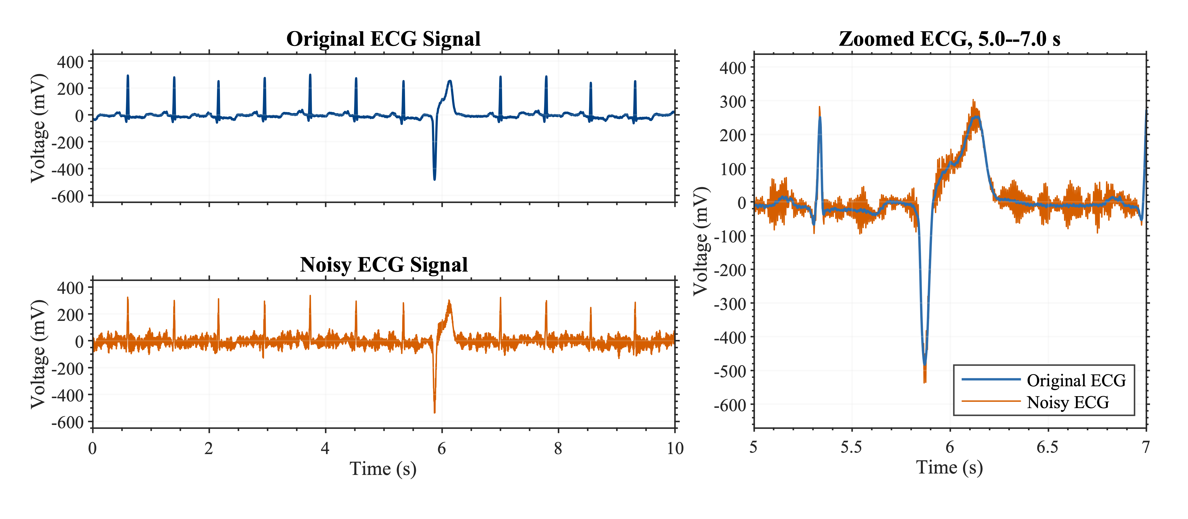 Original and noisy ECG recordings