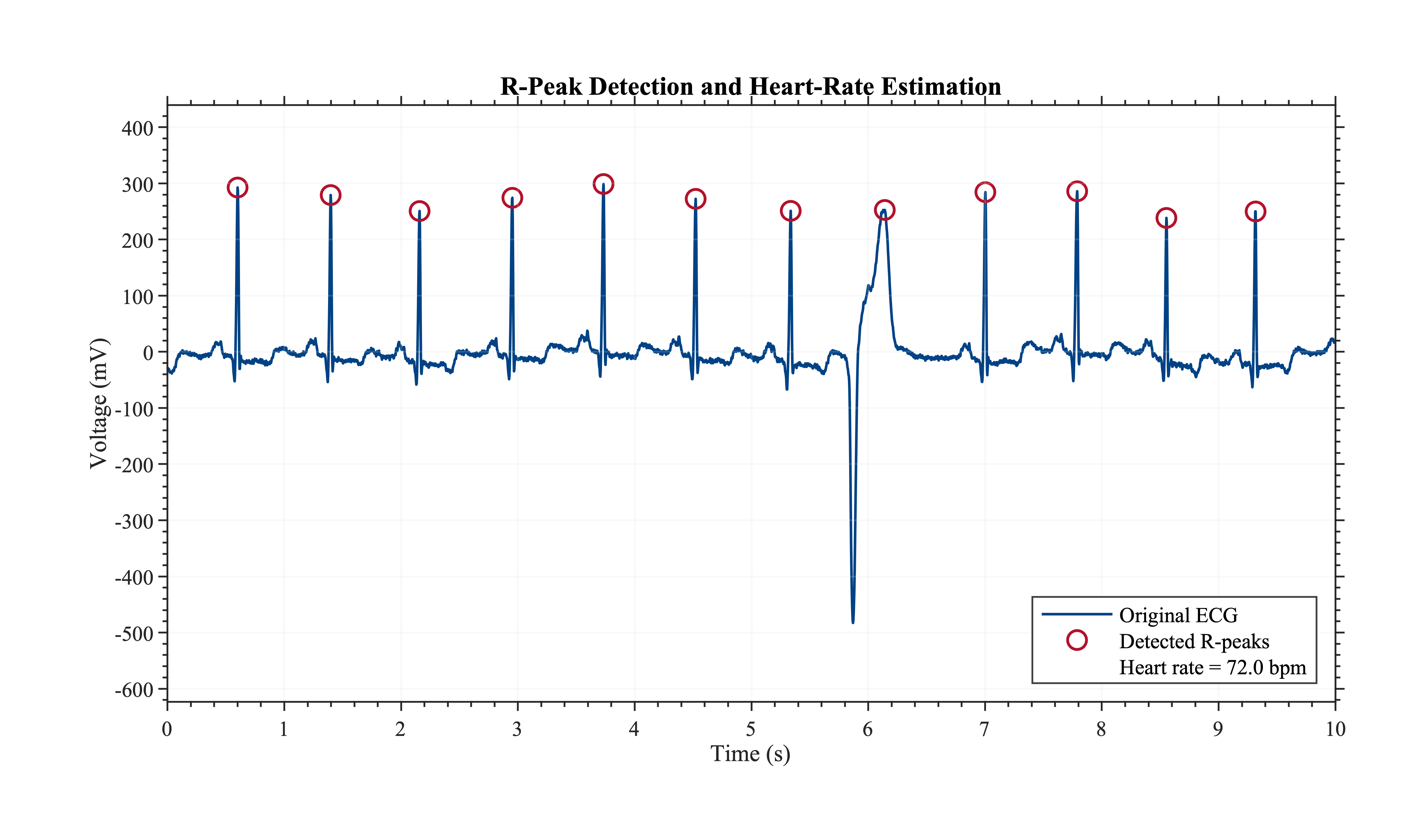 Detected positive ECG peaks and a nominal heart-rate estimate