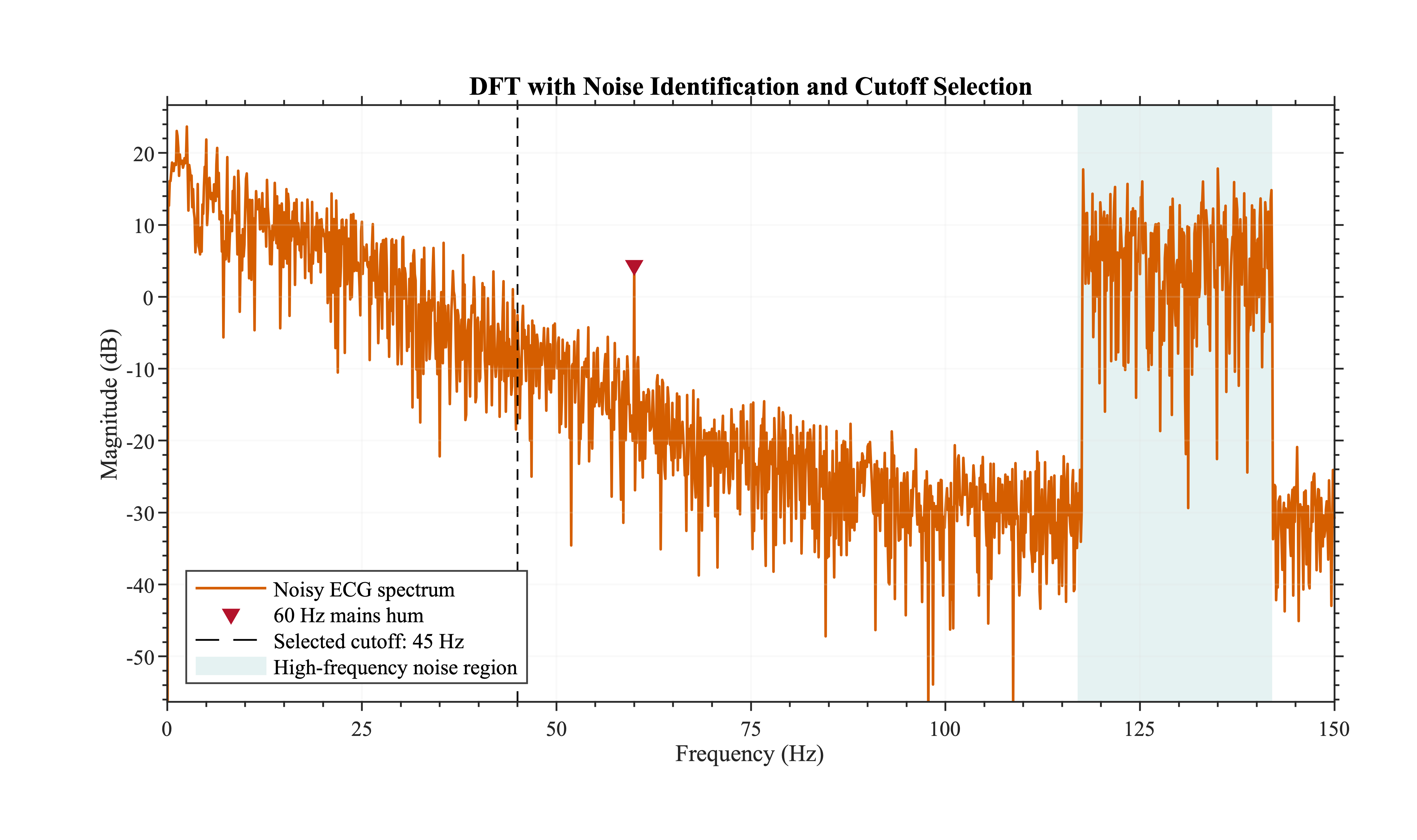 DFT of the noisy ECG with the 60 Hz interference, high-frequency band, and 45 Hz cutoff marked