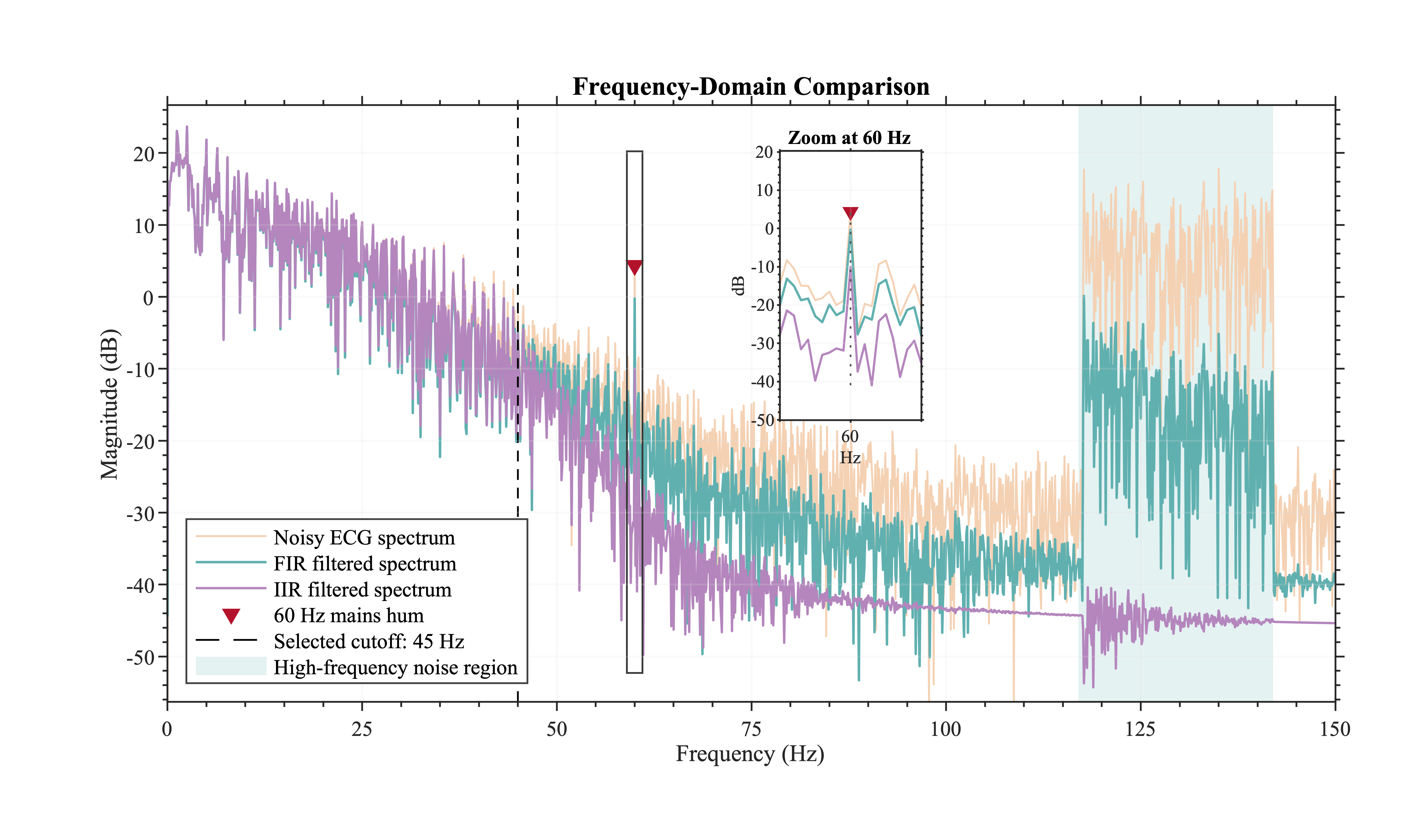 Frequency-domain comparison of noisy, FIR-filtered, and IIR-filtered ECG signals